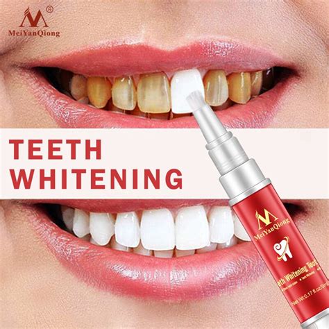 Ancient Wisdom in Modern Life: Supernatural Teeth Whitening